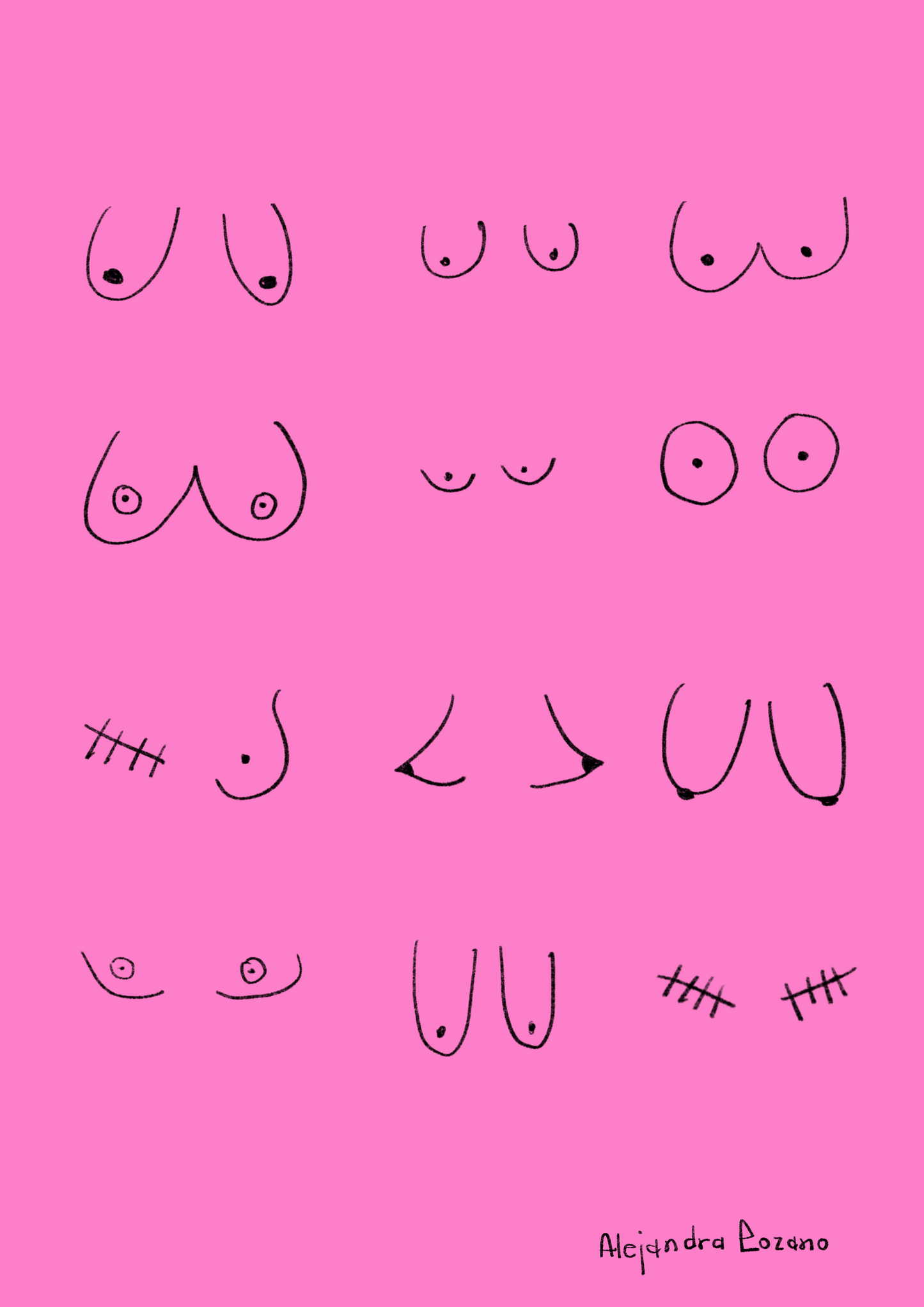 lamina-cancer-de-mama-alejandra-lozano